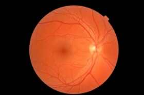Embryonic Stem Cells Appear Safe, May Help Eye Disease