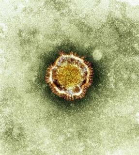 Scientists find how deadly new virus infects human cells
